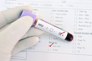 Эпидемия ВИЧ впервые объявлена в России